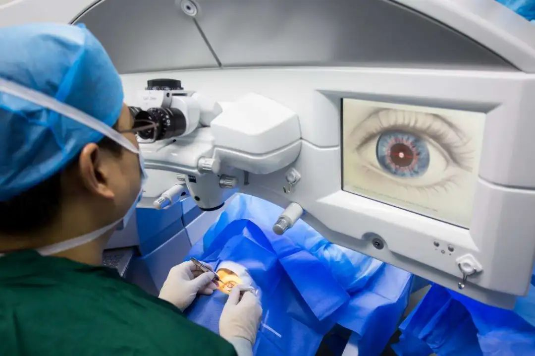 视百年眼科激光近视手术有年龄限制吗？