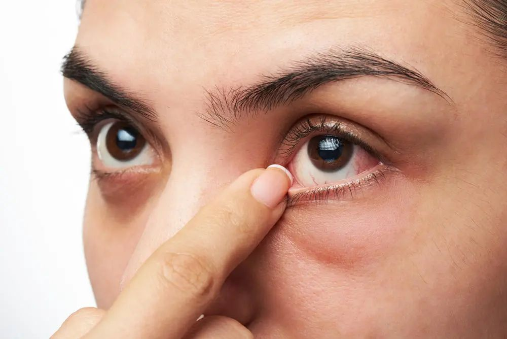 视百年：眼部疾病有哪些？这几种可以了解下
